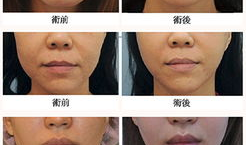 下半脸图片,探寻面部表情的深层奥秘